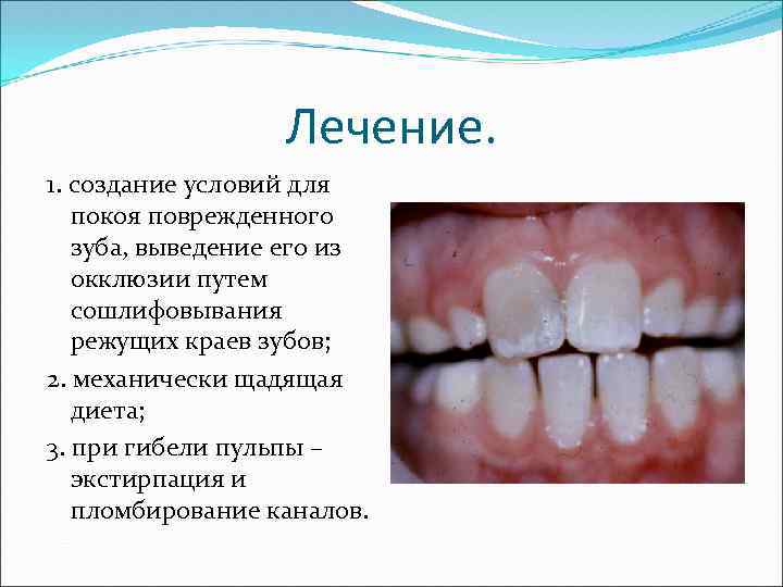 Лечение. 1. создание условий для покоя поврежденного зуба, выведение его из окклюзии путем сошлифовывания
