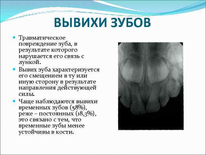 Травма зубов презентация