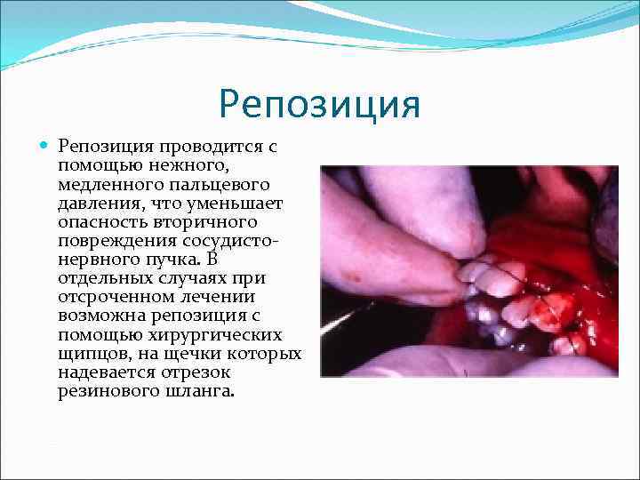 Репозиция проводится с помощью нежного, медленного пальцевого давления, что уменьшает опасность вторичного повреждения сосудистонервного