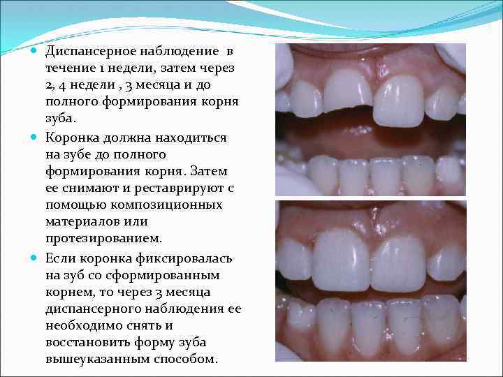  Диспансерное наблюдение в течение 1 недели, затем через 2, 4 недели , 3