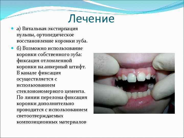 Лечение а) Витальная экстирпация пульпы, ортопедическое восстановление коронки зуба. б) Возможно использование коронки собственного