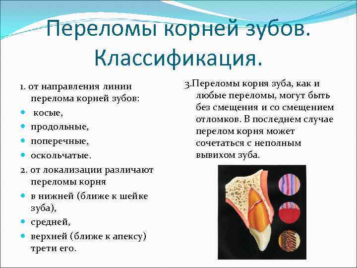 Переломы корней зубов. Классификация. 1. от направления линии перелома корней зубов: косые, продольные, поперечные,