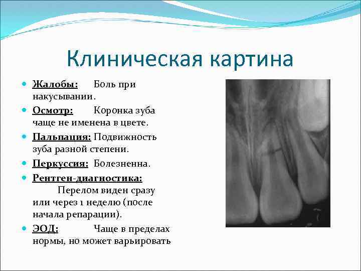 Травма зубов презентация