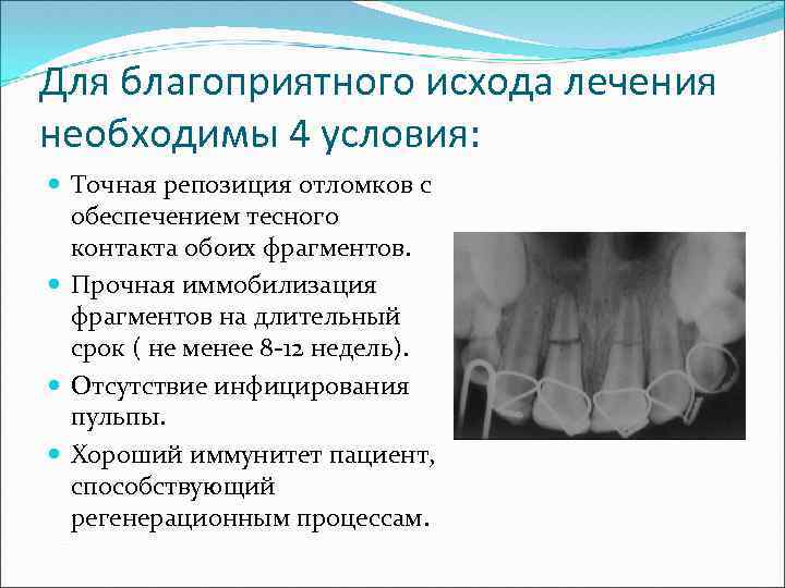 Для благоприятного исхода лечения необходимы 4 условия: Точная репозиция отломков с обеспечением тесного контакта