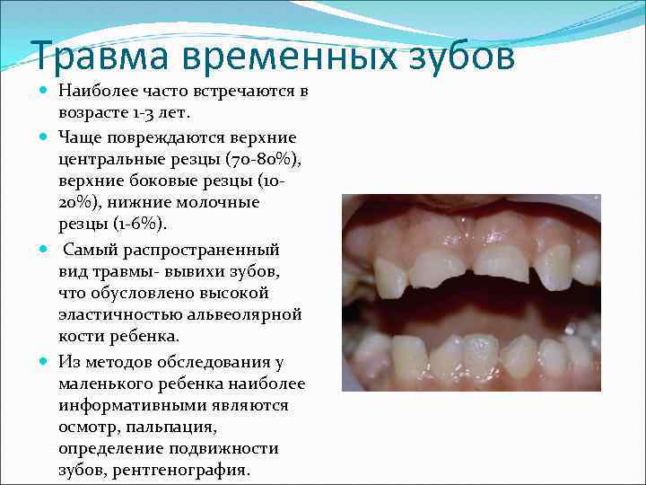 Травма временных зубов Наиболее часто встречаются в возрасте 1 -3 лет. Чаще повреждаются верхние