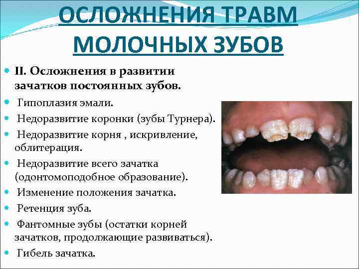 ОСЛОЖНЕНИЯ ТРАВМ МОЛОЧНЫХ ЗУБОВ II. Осложнения в развитии зачатков постоянных зубов. Гипоплазия эмали. Недоразвитие