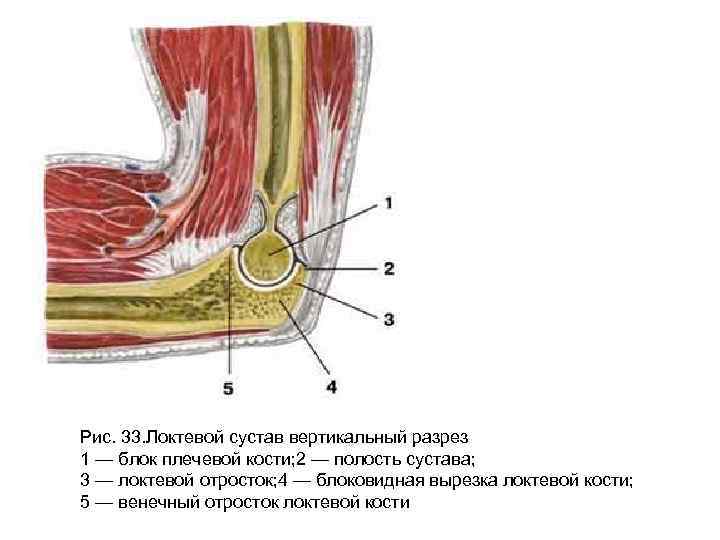 Бурсит локтевого отростка