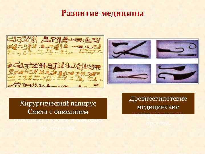 Развитие медицины Хирургический папирус Смита с описанием различных травм и методов их лечения. Древнеегипетские
