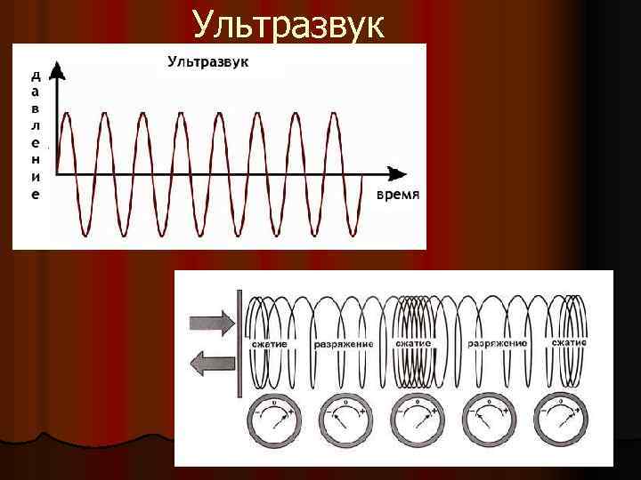 Ультразвук 