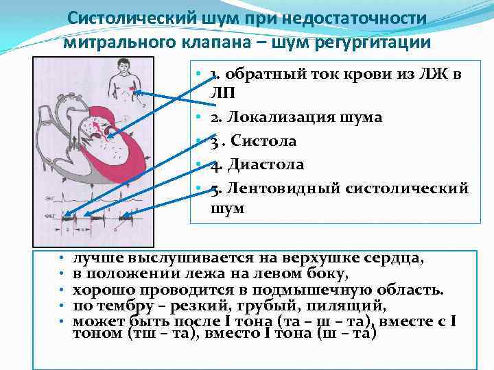 Презентация на тему недостаточность митрального клапана