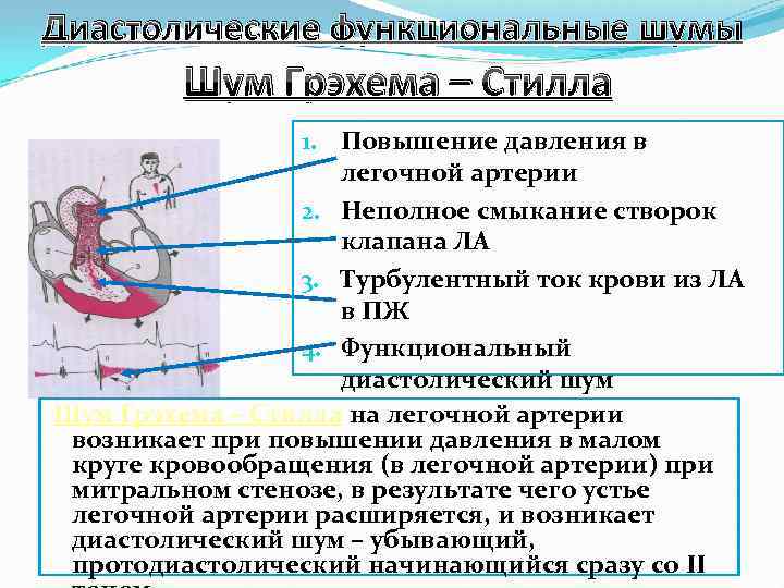 Функциональные шумы Грехема Стилла. Диастолический шум Грехема-Стилла это. Механизм возникновения шума Грехема-Стилла. Диастолический шум на легочной артерии.