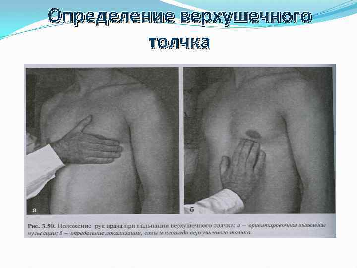 Определение верхушечного толчка 