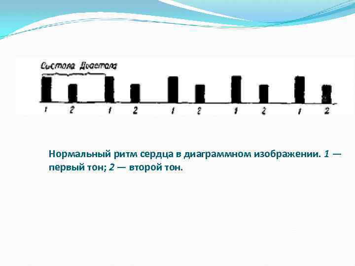 Нормальный ритм сердца в диаграммном изображении. 1 — первый тон; 2 — второй тон.