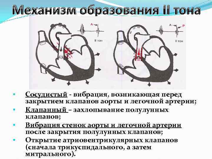 Механизм образования II тона • • Сосудистый - вибрация, возникающая перед закрытием клапанов аорты