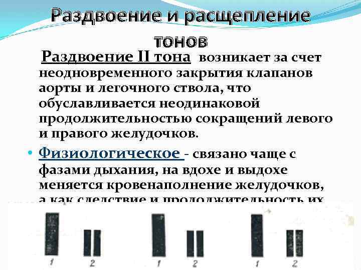 Раздвоение и расщепление тонов Раздвоение II тона возникает за счет неодновременного закрытия клапанов аорты