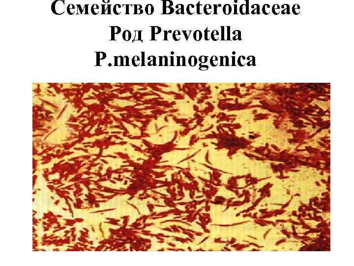 Семейство Bacteroidaceae Род Prevotella P. melaninogenica 
