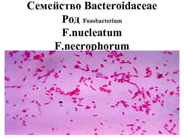 Семейство Bacteroidaceae Род Fusobacterium F. nucleatum F. necrophorum 