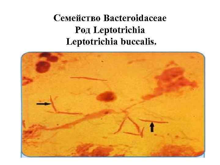 Семейство Bacteroidaceae Род Leptotrichia buccalis. 