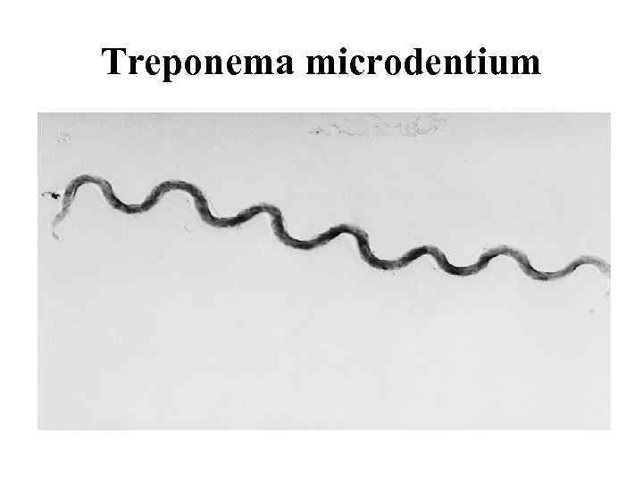Treponema microdentium 