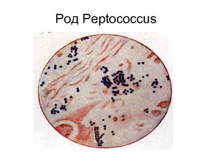 Род Peptococcus 