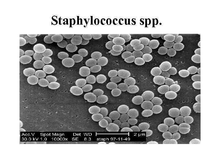 Staphylococcus spp. 