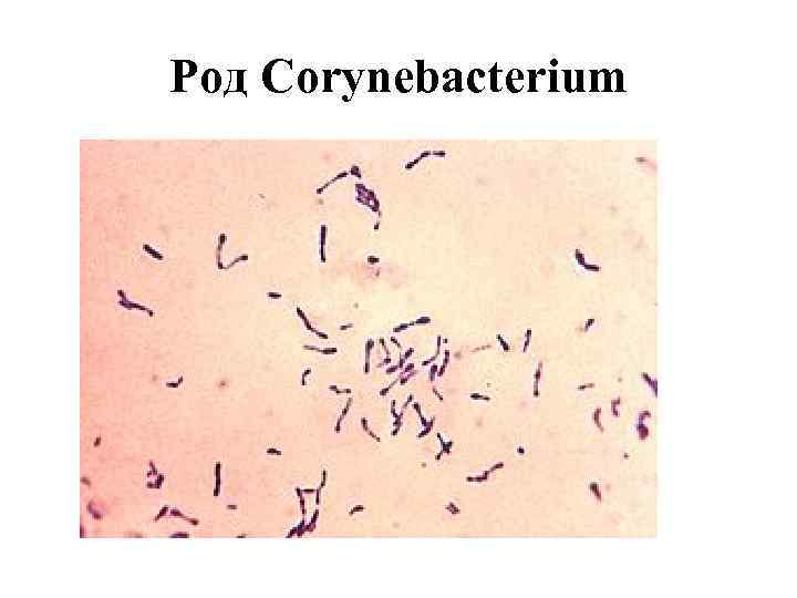 Род Corynebacterium 