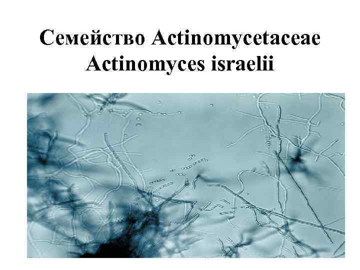 Семейство Actinomycetaceae Actinomyces israelii 