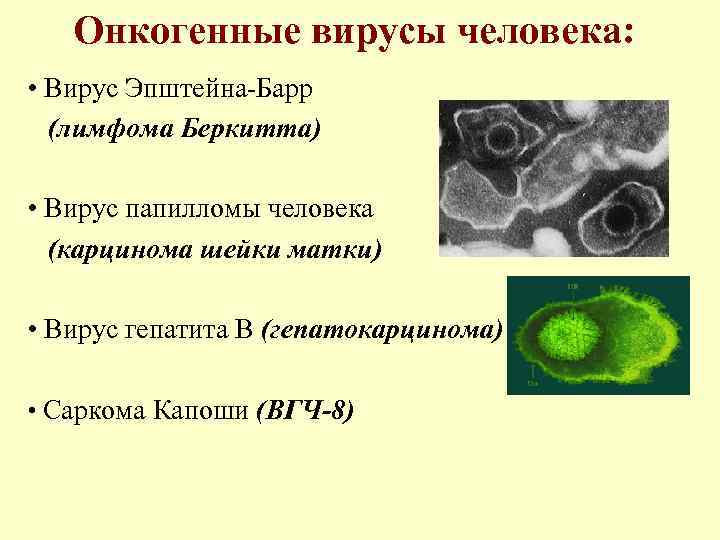 Онкогенные вирусы человека: • Вирус Эпштейна-Барр (лимфома Беркитта) • Вирус папилломы человека (карцинома шейки