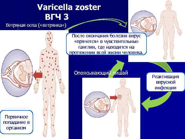  Varicella ВГЧ 3 zoster Ветряная оспа ( «ветрянка» ) После окончания болезни вирус