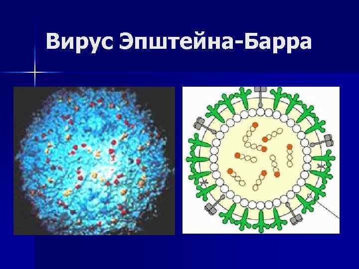 Вирус Эпштейна-Барра 