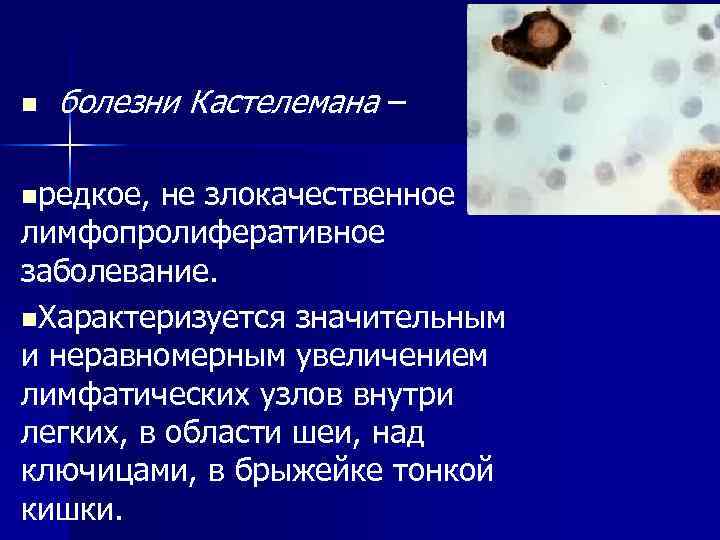 n болезни Кастелемана – nредкое, не злокачественное лимфопролиферативное заболевание. n. Характеризуется значительным и неравномерным