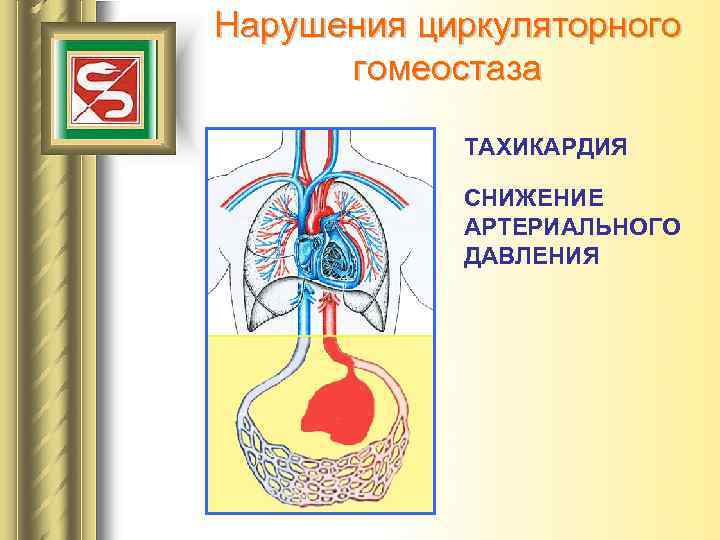 Нарушения циркуляторного гомеостаза ТАХИКАРДИЯ СНИЖЕНИЕ АРТЕРИАЛЬНОГО ДАВЛЕНИЯ 