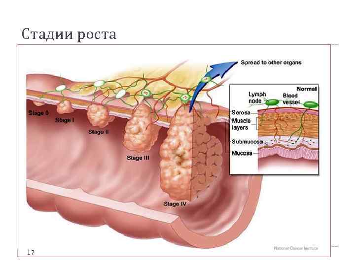Стадии роста 17 