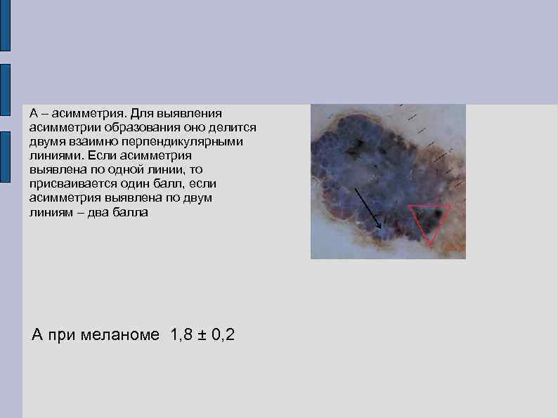 А – асимметрия. Для выявления асимметрии образования оно делится двумя взаимно перпендикулярными линиями. Если