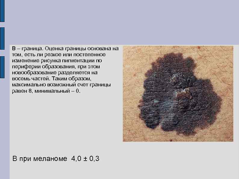 В – граница. Оценка границы основана на том, есть ли резкое или постепенное изменение