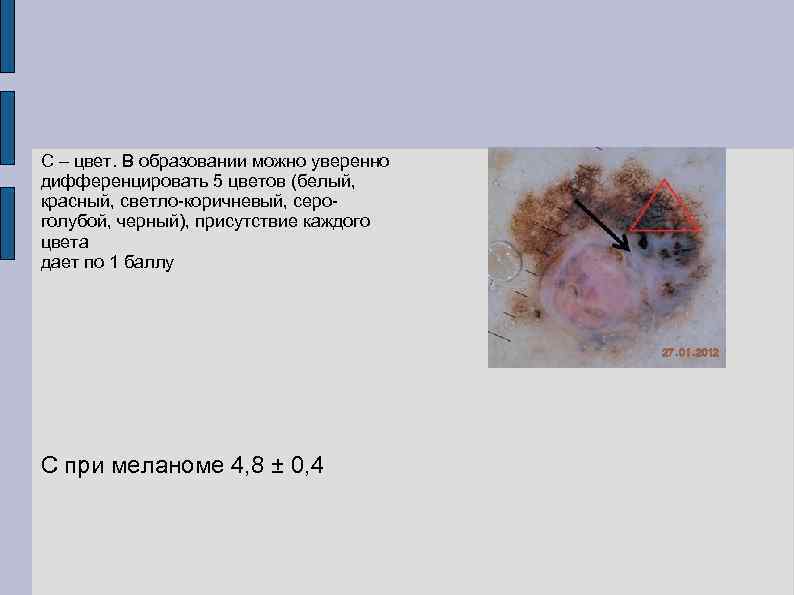 С – цвет. В образовании можно уверенно дифференцировать 5 цветов (белый, красный, светло-коричневый, сероголубой,