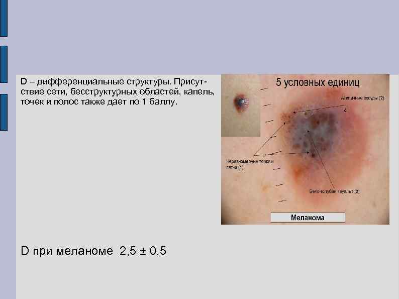 D – дифференциальные структуры. Присутствие сети, бесструктурных областей, капель, точек и полос также дает