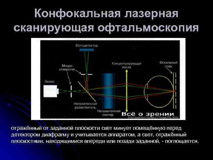 Конфокальная лазерная сканирующая офтальмоскопия отражённый от заданной плоскости свет минует помещённую перед детектором диафрагму