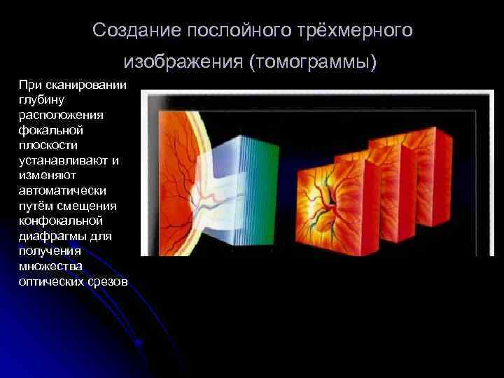 Создание послойного трёхмерного изображения (томограммы) При сканировании глубину расположения фокальной плоскости устанавливают и изменяют