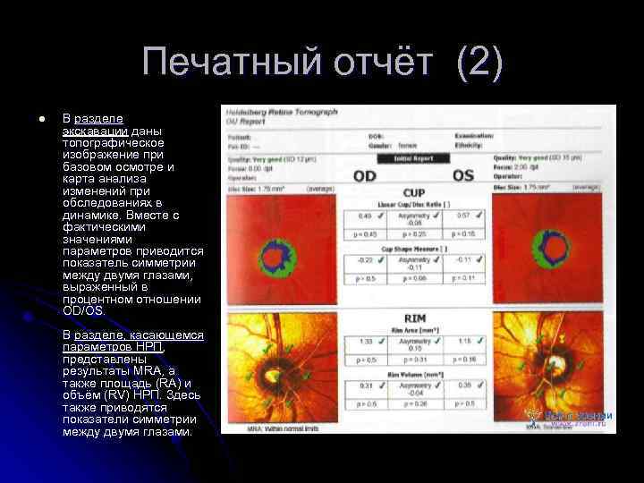 Печатный отчёт (2) l В разделе экскавации даны топографическое изображение при базовом осмотре и