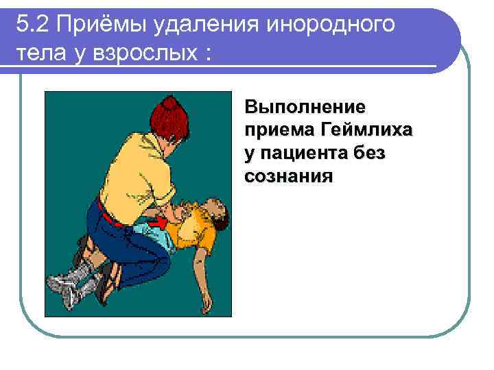 5. 2 Приёмы удаления инородного тела у взрослых : Выполнение приема Геймлиха у пациента