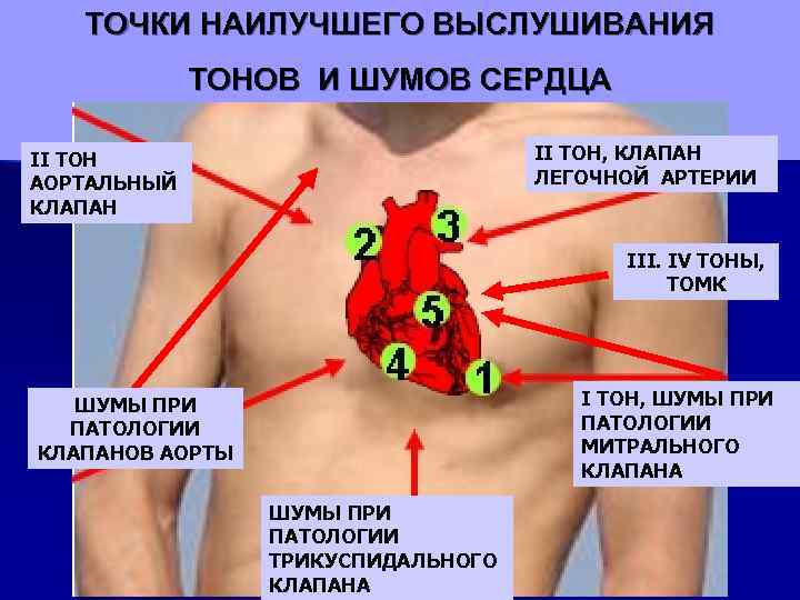 ТОЧКИ НАИЛУЧШЕГО ВЫСЛУШИВАНИЯ ТОНОВ И ШУМОВ СЕРДЦА II ТОН, КЛАПАН ЛЕГОЧНОЙ АРТЕРИИ II ТОН