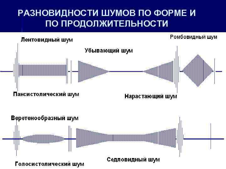 РАЗНОВИДНОСТИ ШУМОВ ПО ФОРМЕ И ПО ПРОДОЛЖИТЕЛЬНОСТИ 