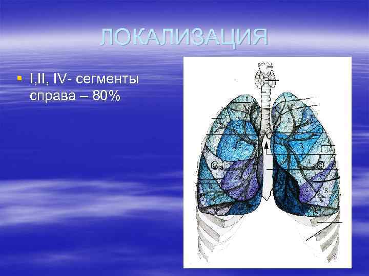 ЛОКАЛИЗАЦИЯ § I, IV- сегменты справа – 80% 