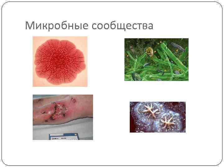 Микробные сообщества 