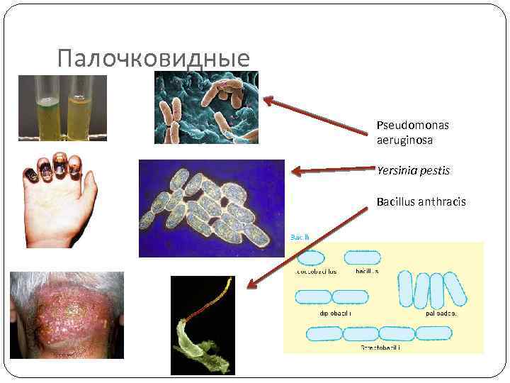 Экология микроорганизмов микробиология. Экология микроорганизмов схема. Распространение микроорганизмов в окружающей среде. Распространение микроорганизмов в окружающей среде схема. Экология микроорганизмов тест.