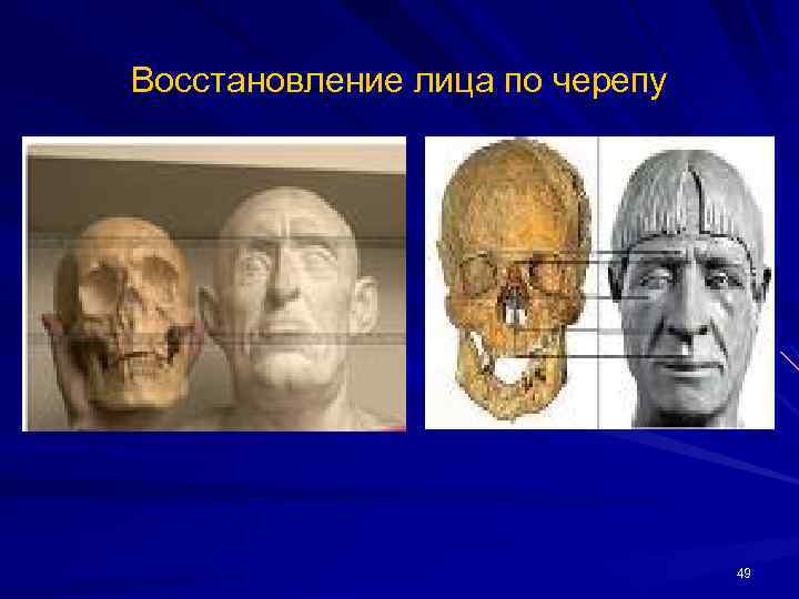 Внешний облик братьев. Портретная экспертиза по черепу. Этапы восстановления лица по черепу. Экспертиза восстановление лица по черепу. Идентификация лица по черепу человека,.