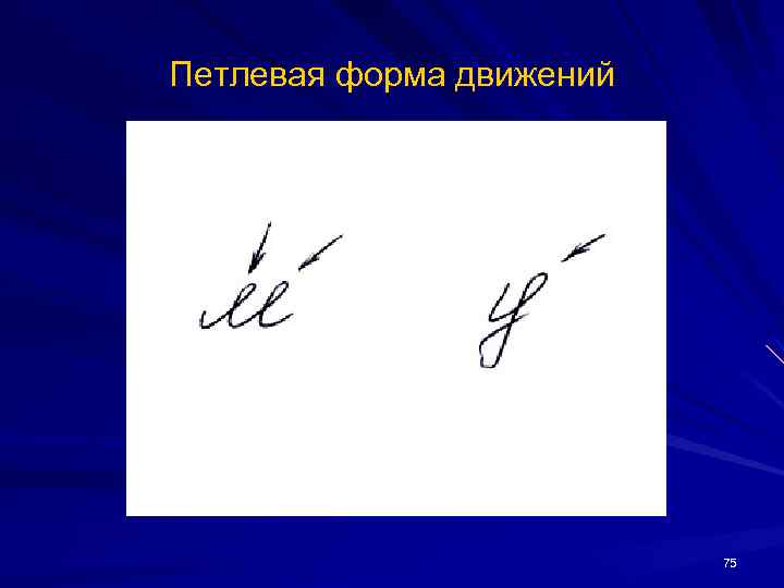 Петлевая форма движений 75 