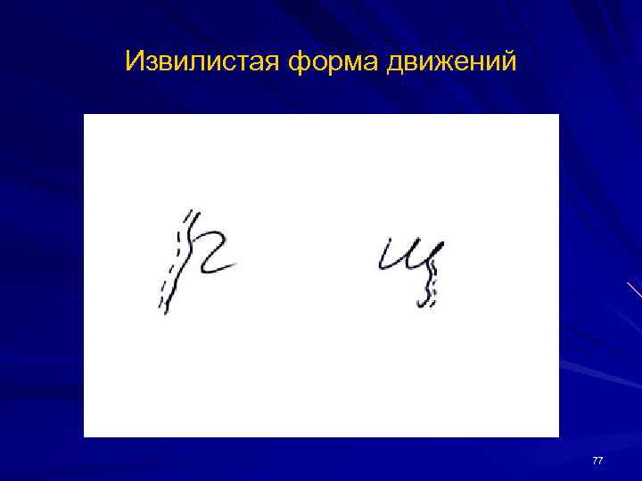 Извилистая форма движений 77 