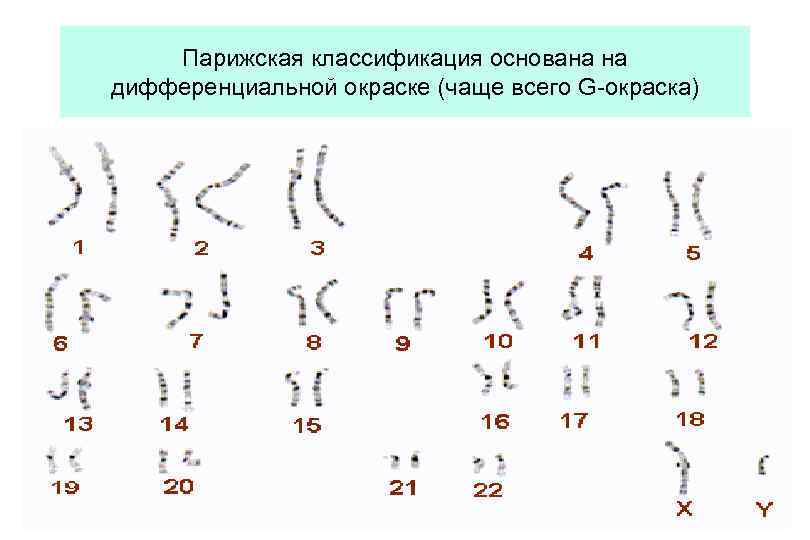 Парижская классификация основана на дифференциальной окраске (чаще всего G-окраска) 